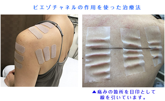 東洋医学・鍼灸