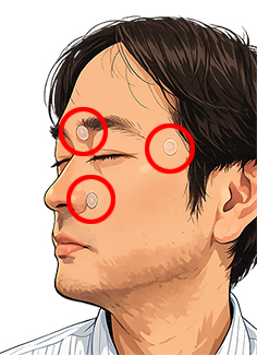 新薬(アミロイドβターゲット薬)と足三里パルス(鍼灸)の比較